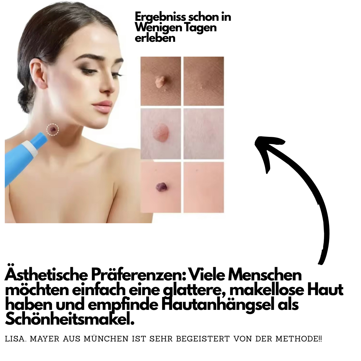 Hautanhängsel entfernt jeden Fleck am Körper!