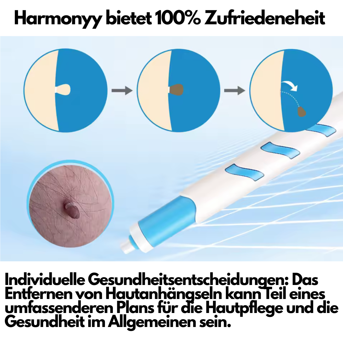 Hautanhängsel entfernt jeden Fleck am Körper!
