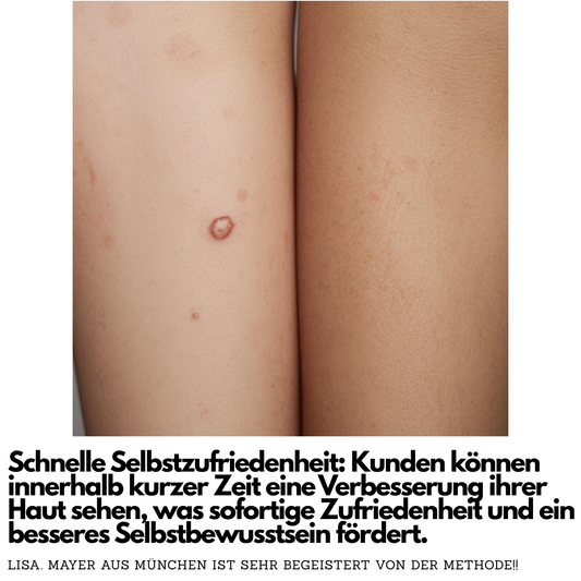 Hautanhängsel entfernt jeden Fleck am Körper!